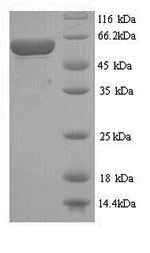 SDS-PAGE - Recombinant Pneumolysin protein (His tag) (AB240861)