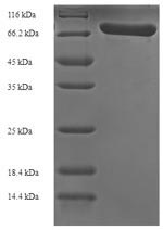 SDS-PAGE - Recombinant Pneumolysin protein (Tagged) (AB236193), expandable thumbnail