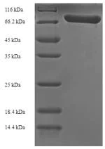 SDS-PAGE - Recombinant Pneumolysin protein (Tagged) (AB236193)