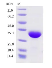 SDS-PAGE - Recombinant Protein A (AB319135)