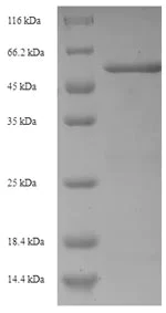 SDS-PAGE - Recombinant Pseudomonas aeruginosa Beta-lactamase protein (His tag) (AB226274)