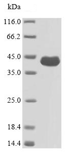 SDS-PAGE - Recombinant Pseudomonas aeruginosa ompF protein (His tag) (AB236164)