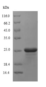 SDS-PAGE - Recombinant Puromycin N-acetyltransferase protein (His tag) (AB236201)