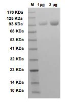 SDS-PAGE - Recombinant Pyruvate phosphate dikinase protein (Active) (AB286038)
