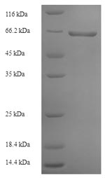 SDS-PAGE - Recombinant Rabies Virus Glycoprotein (His tag) (AB225663)