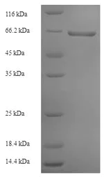 SDS-PAGE - Recombinant Rabies Virus Glycoprotein (His tag) (AB225663)