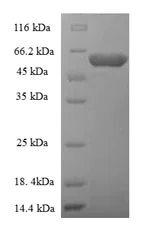 SDS-PAGE - Recombinant Rabies virus (Strain India) (RABV) G protein (Tagged) (AB225593)