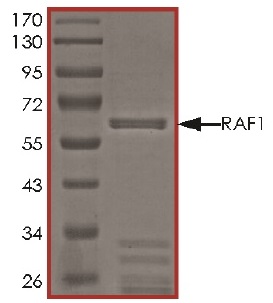 Western blot - Recombinant Raf1 (mutated Y340E + Y341E) protein (Active) (AB62292), expandable thumbnail
