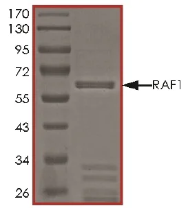Western blot - Recombinant Raf1 (mutated Y340E + Y341E) protein (Active) (AB62292)