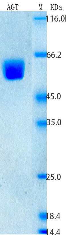 Recombinant Rat AGT Protein Standard (His tag)