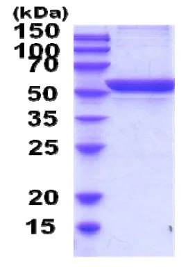 SDS-PAGE - Recombinant Rat Alanine Transaminase protein (His tag N-Terminus) (AB207123)