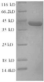 SDS-PAGE - Recombinant Rat Alpha-synuclein protein (Tagged) (AB226434)