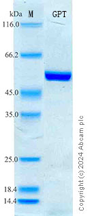 SDS-PAGE - Recombinant Rat ALT Protein Standard (His tag) (AB316725), expandable thumbnail