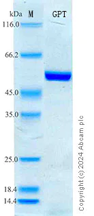 SDS-PAGE - Recombinant Rat ALT Protein Standard (His tag) (AB316725)