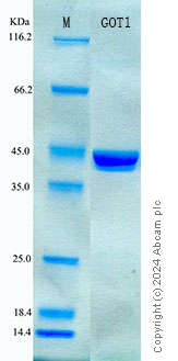 SDS-PAGE - Recombinant Rat AST Protein Standard (His tag) (AB316580), expandable thumbnail