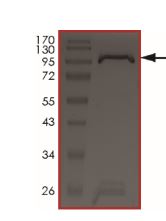 SDS-PAGE - Recombinant rat BTK protein (AB207956), expandable thumbnail