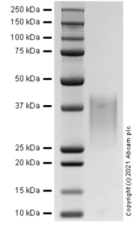 SDS-PAGE - Recombinant Rat CCL2/JE/MCP-1 Protein (AB283927)