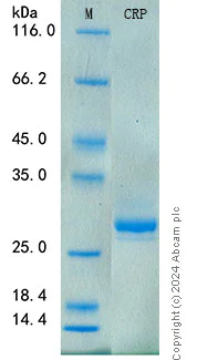 SDS-PAGE - Recombinant Rat CRP Protein Standard (His tag) (AB316583)