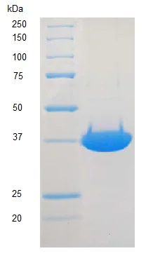 SDS-PAGE - Recombinant rat DNA Polymerase beta protein (AB123225)