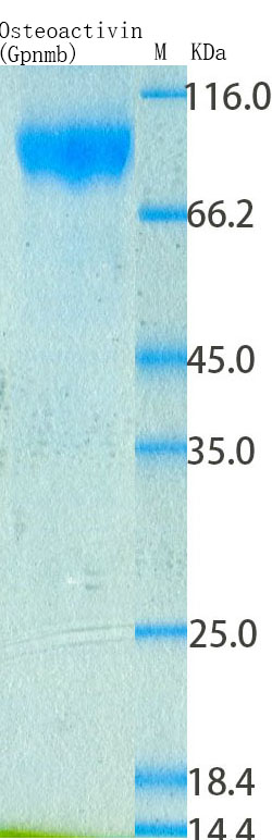 SDS-PAGE - Recombinant Rat GPNMB Protein Standard (His tag) (AB316498), expandable thumbnail