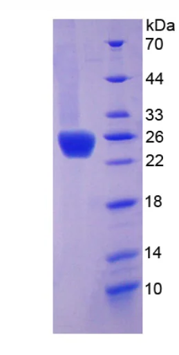 SDS-PAGE - Recombinant Rat Growth Hormone protein (Tagged) (AB275557)