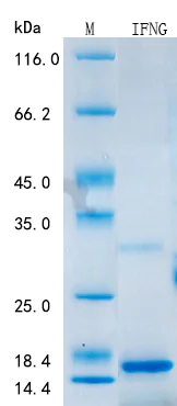 SDS-PAGE - Recombinant Rat IFN gamma Protein Standard (His tag) (AB316433)