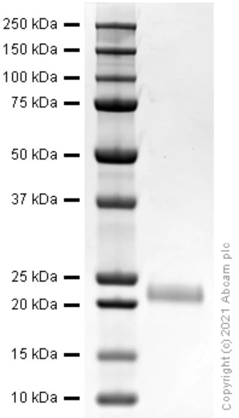 SDS-PAGE - Recombinant rat IL-1 beta protein (Active) (AB281807)