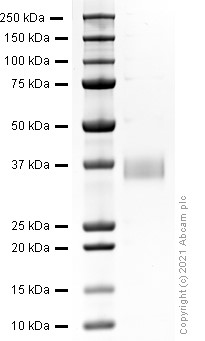 Recombinant rat IL-1 beta protein (Active)