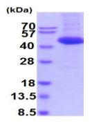 SDS-PAGE - Recombinant Rat IL-11RA protein (His tag) (AB219288), expandable thumbnail
