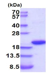SDS-PAGE - Recombinant Rat IL-1RA protein (His tag N-Terminus) (AB201897)