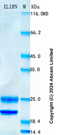 SDS-PAGE - Recombinant Rat IL-1Ra Protein Standard (His tag) (AB322101)