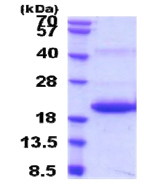 SDS-PAGE - Recombinant Rat IL-33 protein (His tag N-Terminus) (AB207126)