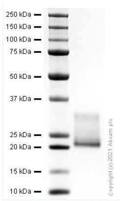 SDS-PAGE - Recombinant rat IL-6 protein (Active) (AB281812)
