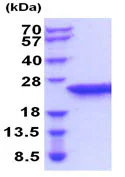 SDS-PAGE - Recombinant Rat Lipocalin-2 / NGAL protein (His tag N-Terminus) (AB207148)