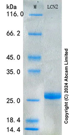SDS-PAGE - Recombinant Rat Lipocalin-2 Protein Standard (His tag) (AB316651)