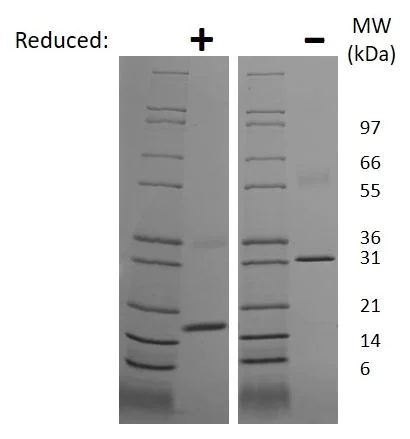 SDS-PAGE - Recombinant rat M-CSF protein (Active) (AB269198)