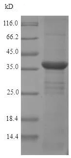 SDS-PAGE - Recombinant Rat Monoacylglycerol Lipase/MGL protein (His tag) (AB226888)