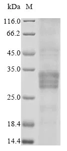 SDS-PAGE - Recombinant Rat Oncostatin M/OSM protein (His tag) (AB267841)