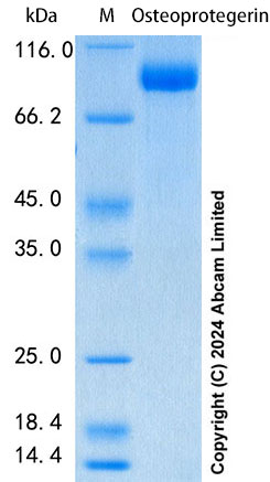SDS-PAGE - Recombinant Rat Osteoprotegerin Protein Standard (His tag) (AB316588), expandable thumbnail
