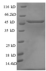 SDS-PAGE - Recombinant Rat p53 protein (His tag) (AB226419), expandable thumbnail