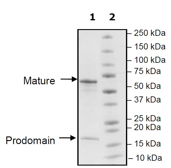 SDS-PAGE - Recombinant Rat PCSK9 protein (His tag C-Terminus + Avi tag C-Terminus) (AB271655)