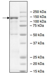 SDS-PAGE - Recombinant rat PDE4D protein (AB198442), expandable thumbnail