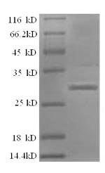 SDS-PAGE - Recombinant Rat Plasma Kallikrein 1B protein (His tag) (AB226435), expandable thumbnail