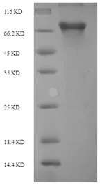 SDS-PAGE - Recombinant Rat PLBD2 protein (Tagged) (AB226421)