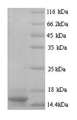 SDS-PAGE - Recombinant Rat PTMA protein (His tag) (AB226237)