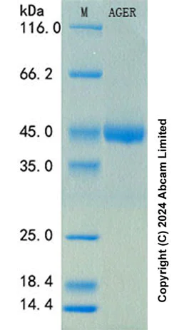 SDS-PAGE - Recombinant Rat RAGE Protein Standard (His tag) (AB316733)