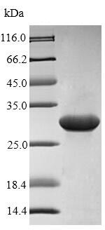 SDS-PAGE - Recombinant Rat S100A9 protein (Tagged) (AB226440), expandable thumbnail