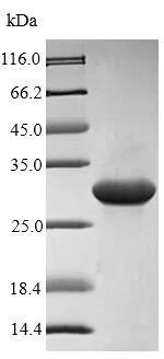 SDS-PAGE - Recombinant Rat S100A9 protein (Tagged) (AB226440)