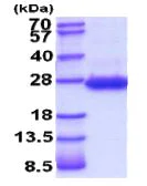 SDS-PAGE - Recombinant Rat TIMP1 protein (His tag C-Terminus) (AB206796)