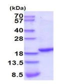 SDS-PAGE - Recombinant Rat TNF alpha protein (AB201903)
